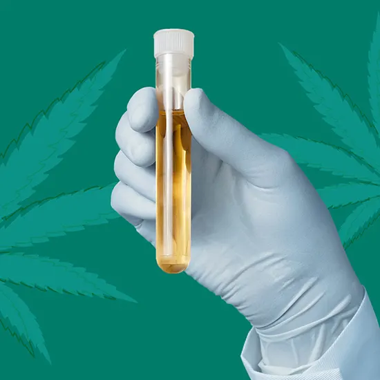 Cannabinoids (Marijuana) Screen Urine